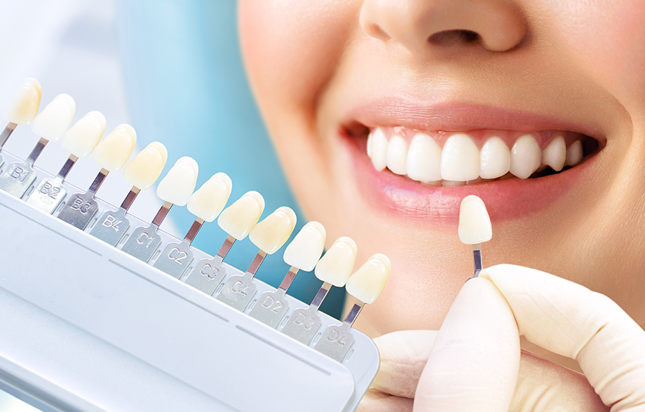 ホワイトニングは虫歯・歯周病予防に効果的
