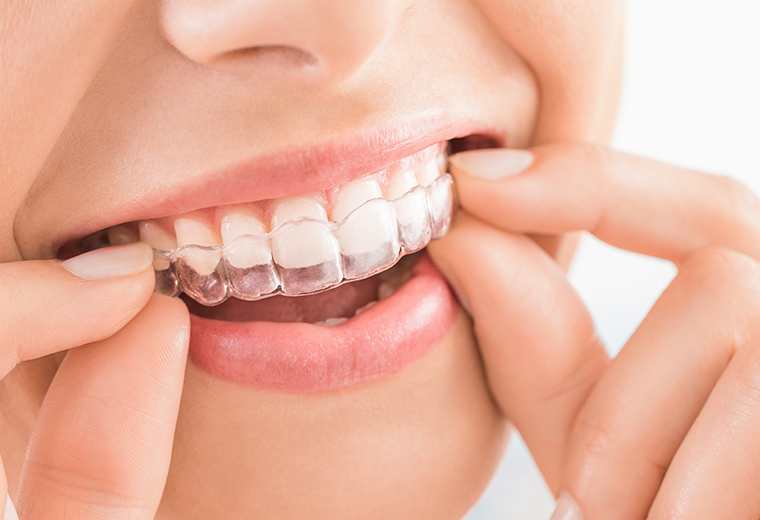 スマーティーはこんな方におすすめ