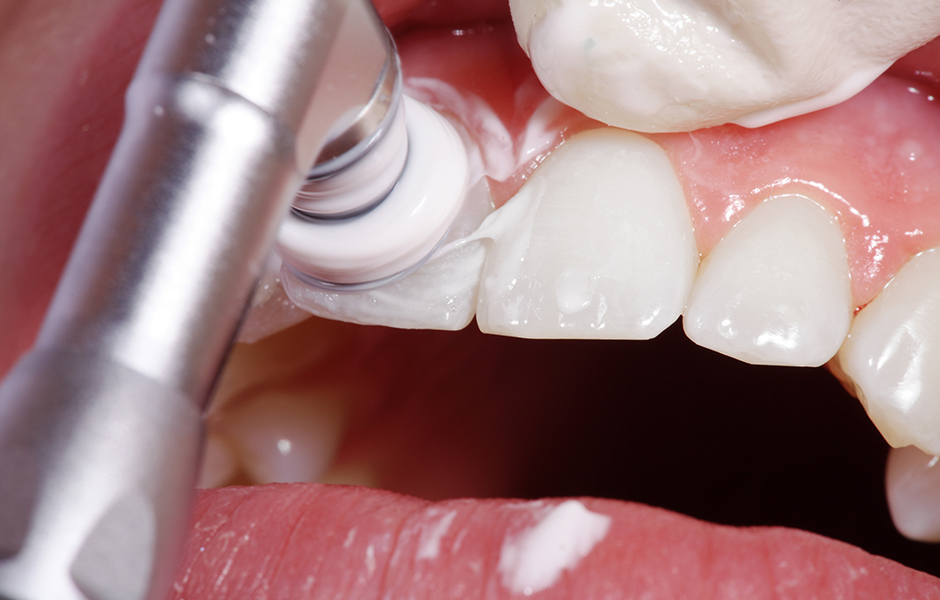 歯科衛生士が患者さまと一緒に健康的なお口を保つ